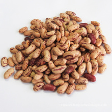 Dried Style and Bulk Packing LSKB/Light Speckled Kidney Beans